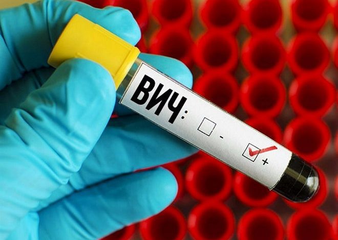 Брестчина: Лунинецкий район на 4 месте по уровню заболеваемости ВИЧ-инфекцией