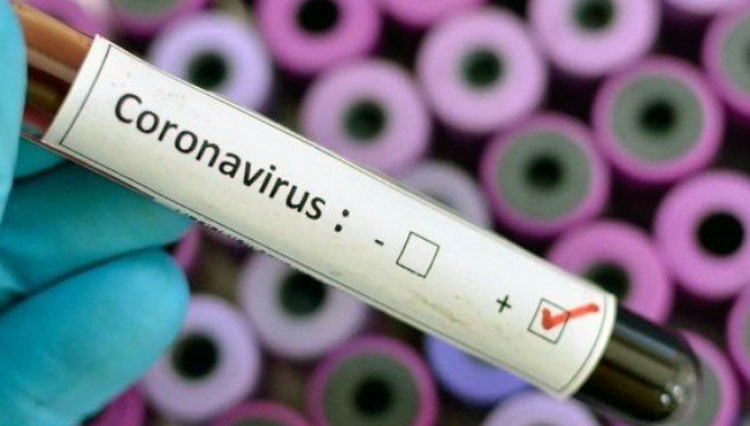 За сутки в Беларуси зарегистрированы 840 пациентов с коронавирусной инфекцией