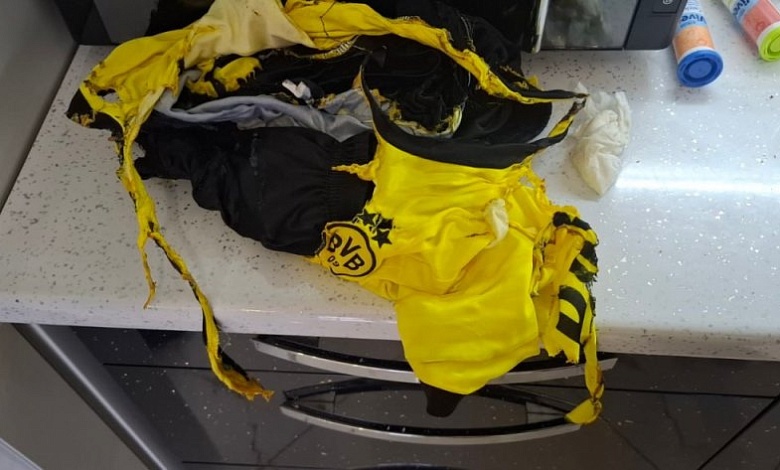 9-летний мальчик в Барановичах получил ожоги - загорелась одежда