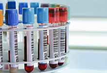 В Лунинецком районе 17 положительных тестов на коронавирус