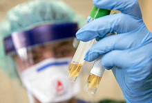 В Беларуси проведено более 21 тыс. тестов на коронавирус