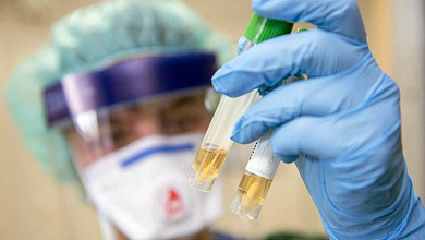 В Беларуси проведено более 21 тыс. тестов на коронавирус