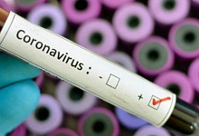В Беларуси у 21 пациента подвержден коронавирус